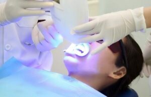 Bảng giá làm răng mới nhất tại Nha Khoa Peace Dentistry